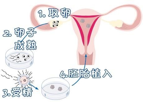 关于爱心供卵代怀助孕咨询哪家好